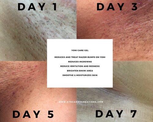 Yoni Care Gel | Post-Shave & Wax Care for Intimate Areas Yoni Care Gel | Post-Shave & Wax Care for Intimate Areas