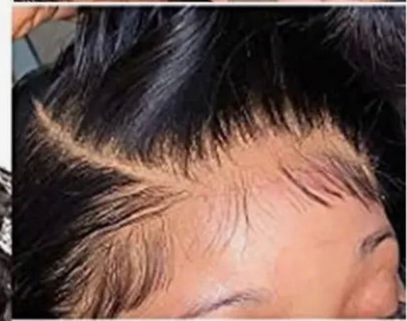 Customizing Services | Frontals, Closures & Wigs Customizing Services | Frontals, Closures & Wigs