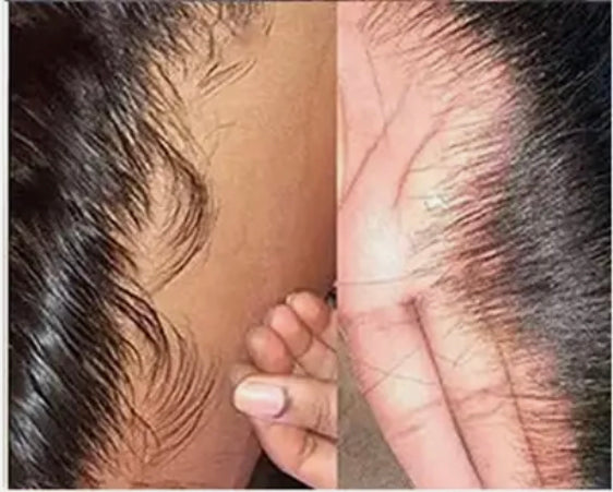 Customizing Services | Frontals, Closures & Wigs Customizing Services | Frontals, Closures & Wigs